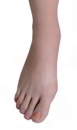 Proteza-partiala-de-picior-.-LISEFRANC-silicon-model-clasic