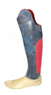 Proteza-pentru-dezarticulatia-de-glezna-.-SYME