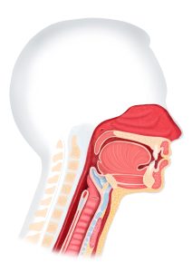 Provox - ilustratie de laringectomie