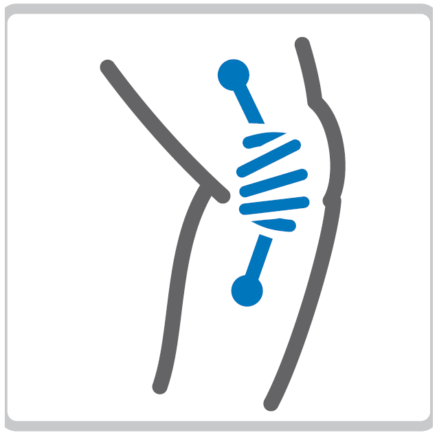 asistență la extensie