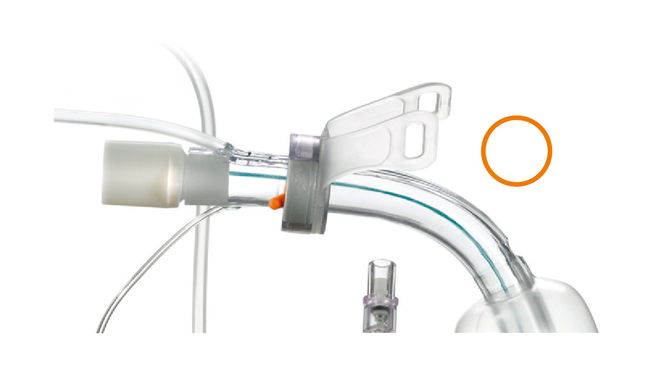 Aspirație subglotică